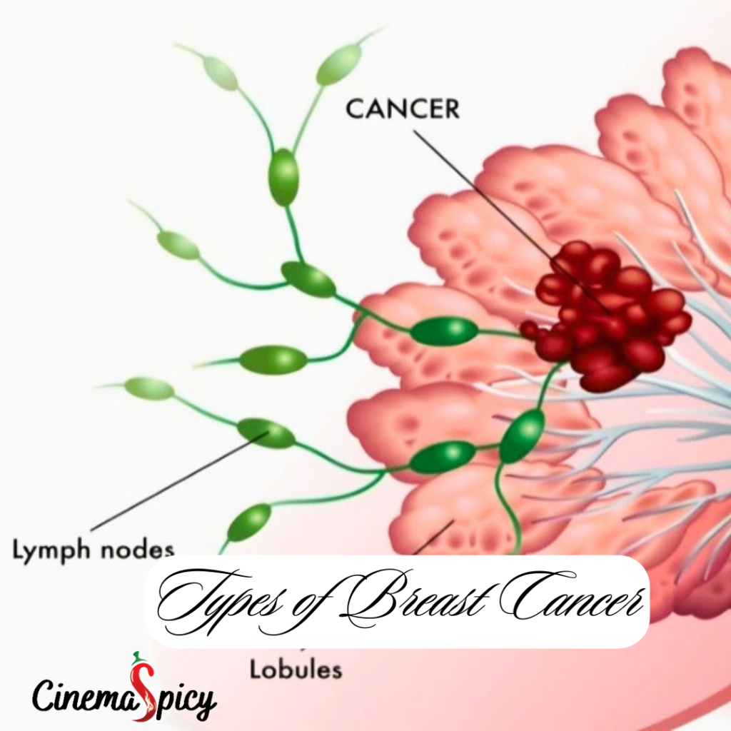 Understanding and Raising Awareness for Breast Cancer